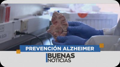 Una Luz De Esperanza Para Los Pacientes De Alzheimer