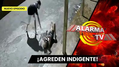 Le Revienta La Cabeza A Pedradas En La Calle