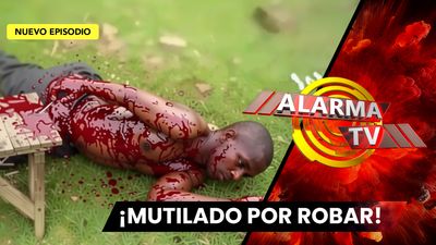 Le Cortaron la Mano por Robar...