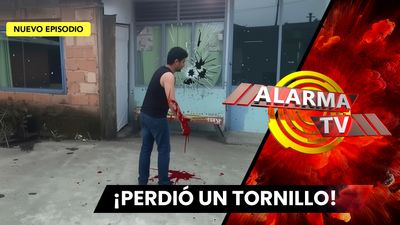 Se le Cayó un Tornillo...