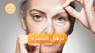 ما أسباب ترهل البشرة وظهور التجاعيد على الوجه؟